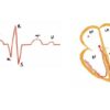 Learn basics of ECG/EKG with interpretation | Teaching & Academics Other Teaching & Academics Online Course by Udemy