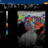 Ultrassonografia Doppler Colorido em Bovinos | Teaching & Academics Other Teaching & Academics Online Course by Udemy