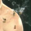 China Zhenjiuology-8.Methods of Moxibustion | Health & Fitness Other Health & Fitness Online Course by Udemy