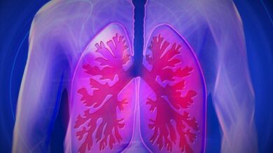 Lungenkrankheit COPD | Health & Fitness General Health Online Course by Udemy