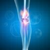 Knee meniscus ('knee cartilage') injury & surgical options | Health & Fitness General Health Online Course by Udemy